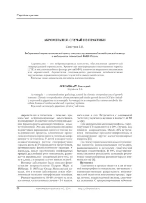 Акромегалия Гигантизм Лицо Симптом Гормон роста, Лицо, угол, лицо, люди png  | Klipartz