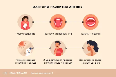 Ангина – причины, симптомы, диагностика и способы лечения заболевания |  Клиника Будь Здоров