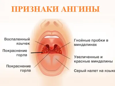 Кашель у Собак — [Что Делать. Основные Причины]