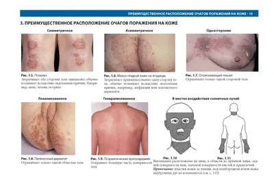 Атлас кожных болезней в картинках фотографии