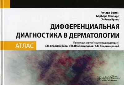 Дерматологический атлас. Олисова О. (5518835) - Купить по цене от 1 206.00  руб. | Интернет магазин SIMA-LAND.RU