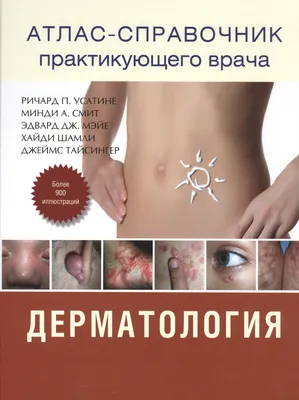 Single ring-shaped tumor on the skin of the temple - Khlebnikova - Russian  Journal of Skin and Venereal Diseases