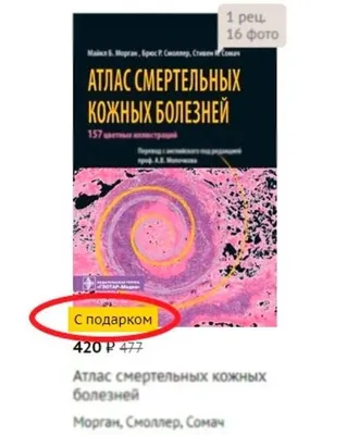 Кожные болезни человека (40 фото)