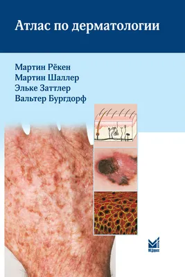 Владимиров Зудин Кожные и венерические болезни Атлас: 1 569 грн. -  Букинистика Киев на Olx