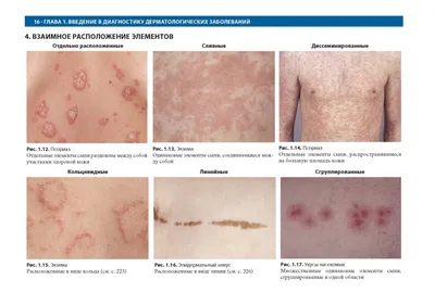 Атлас кожных заболеваний в картинках фотографии