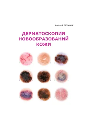 Болезни слизистой оболочки полости рта и губ. Клиника, диагностика и  лечение. Атлас и руководство (Конрад Борк) - купить книгу с доставкой в  интернет-магазине «Читай-город». ISBN: 978-5-91-803005-9