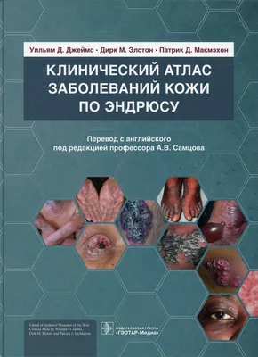 Клинический атлас заболеваний кожи по Эндрюсу - купить с доставкой по  выгодным ценам в интернет-магазине OZON (327452939)