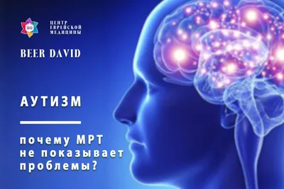 АУТИЗМ,ОСОБЕННОСТЬ КОТОРУЮ МЫ МОЖЕМ ПРИНЯТЬ. | МАОУ ДО \"СШ \"Радий\"