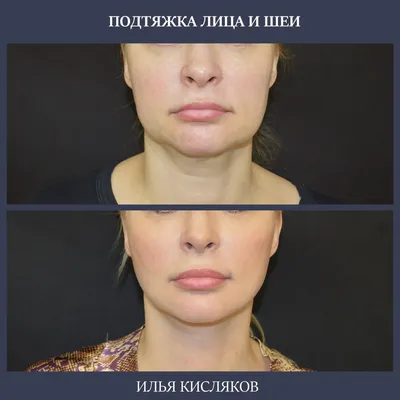 Марият Мухина: Full Face — это чудо — омоложения без операции! • TOP24 •  Омск