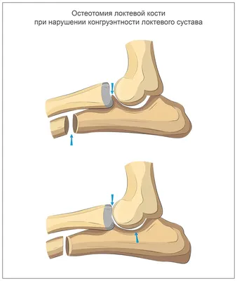 Резекция головки бедра для кошек и собак в ветеринарной клинике vet.city