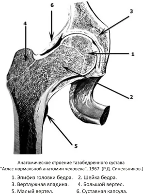 Дисплазия тазобедренных суставов