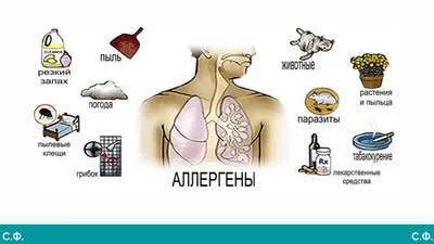 Бронхиальная астма. Современный взгляд на проблему | Ненашева Наталья  Михайловна - купить с доставкой по выгодным ценам в интернет-магазине OZON  (596561173)