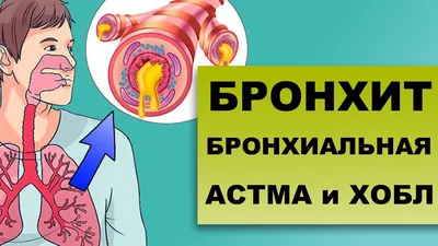 Как связаны бронхиальная астма и здоровье полости рта человека | НоваДент