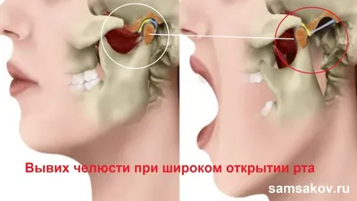 Челюсти | Купить настольную игру (обзор, отзывы, цена) в Игровед