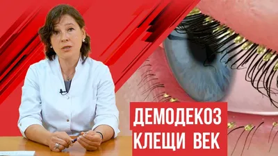 Фото демодекоза ресниц: какие способы помогают улучшить рост ресниц