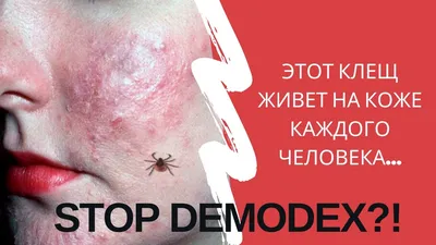 Картинка демодекса на ресницах для использования в косметических статьях 