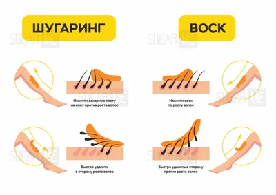 Восковая депиляция - Центр Совершенство Мытищи