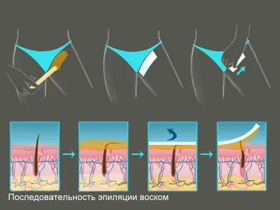 Шугаринг | Депиляция - Le'Di - сеть салонов красоты в Верхней Пышме