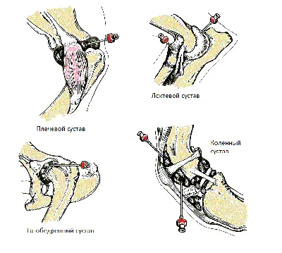 Дисплазия локтевого сустава у собак - симптомы, диагностика, лечение - Сеть  Ветеринарных Центров \"МЕДВЕТ\"