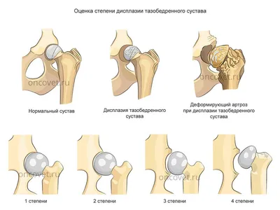 Дисплазия тазобедренных суставов у собак