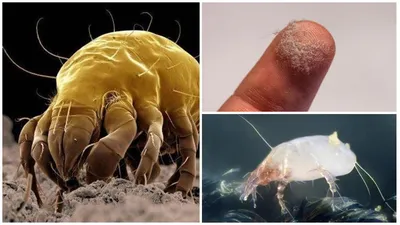 Пылевые клещи в матрасе - как избавиться и чем обработать матрас от опасных  насекомых