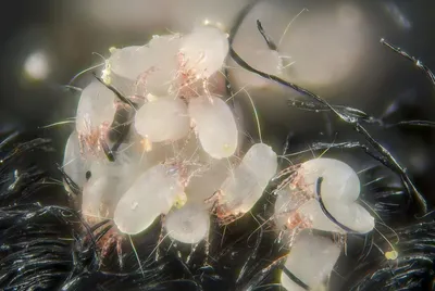 Бельевые клещи: фото и основные характеристики, признаки укусов и способы  избавления от насекомых — Без Тараканов
