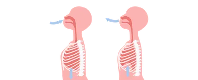 Патологические типы дыхания😷 1️⃣Дыхание Грокко Периодическое дыхание с  нарастанием и убыванием.. | ВКонтакте