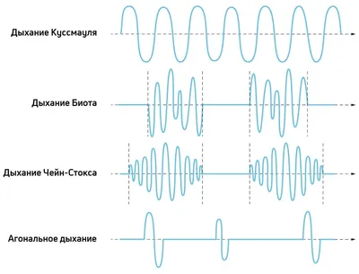 Дыхание. Типы и виды дыхания, значение дыхания