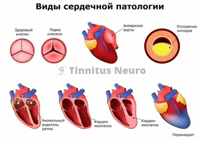 ЭКГ в Новороссийске - цена электрокардиограммы сердца в клинике МКХ