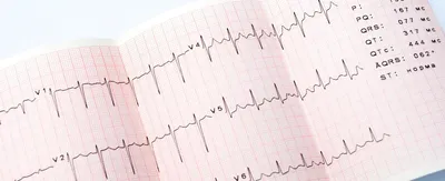 ЭКГ с расшифровкой в Москве. Анализы и расшифровка от лучших специалистов.