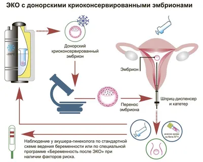 ЭКО по ОМС - счастье совсем рядом в Новосибирске | ЦНМТ