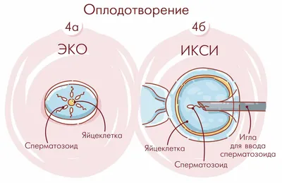 Платное ЭКО в Петербурге 👍 Клиника ЭКО Euromed In Vitro СПб