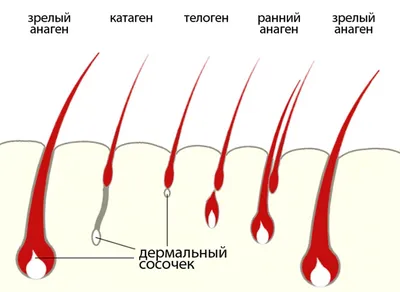 Электроэпиляция на ногах - Центр профессиональной электроэпиляции