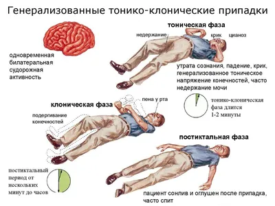 Риски и опасности при эпилепсии.