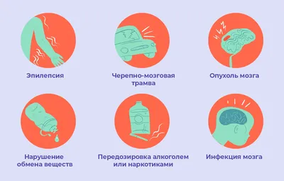 Что такое эпилепсия: причины, симптомы, лечение - Медицинский Центр на  Ботанической