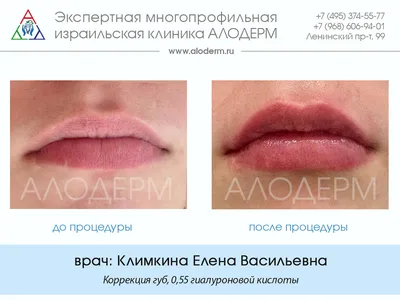 Губки-бантики👄😍 Плоские губы, ярко выраженный плоский бантик🎀 Форма губ  всегда обсуждается.. | ВКонтакте