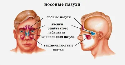 Киста гайморовой пазухи. Симптомы и лечение