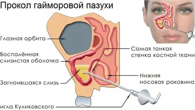 Рентген носовых пазух в Сургуте