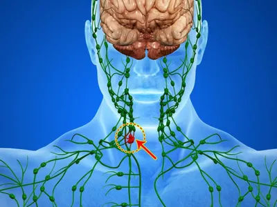 Файл:Lymph node regions-ru.svg — Википедия