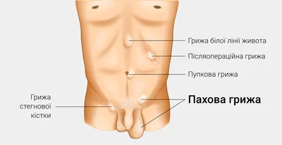 Лимфаденит: симптомы, причины, лечение