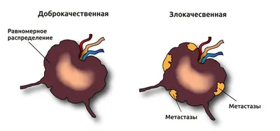 Подкожные образования и что с ними делать | Клиника Рассвет