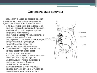 Аппендицит: симптомы, признаки, с какой стороны болит, операция по  удалению, как определить