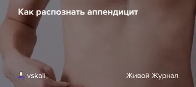 Боль в животе при аппендиците ᐉ Как отличить аппендицит от боли в животе