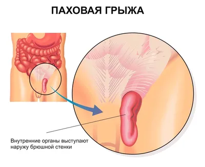 NPR: ваш аппендикс на самом деле не бесполезен. Объясняет профессор  анатомии – K-News