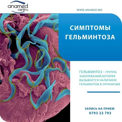 Bayer Адвокат капли от клещей, блох и гельминтов для собак весом более 25  кг - 1 пипетка - купить в Москве | КотМатрос