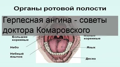 Почему герпетическую ангину не лечат ацикловиром | Пикабу