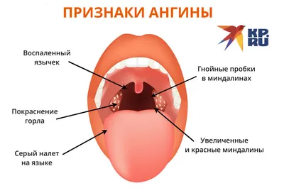 Герпесная ангина и сыпь по телу — 14 ответов | форум Babyblog