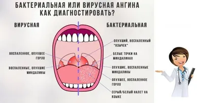 Герпетическая ангина у беременных – почему возникает и что с этим делать? |  О детском здоровье: с врачебного на родительский | Дзен