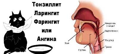 Герпетическая ангина у кормящих – как лечить и не заразить малыша? чем  опасна болезнь | О детском здоровье: с врачебного на родительский | Дзен