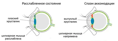 Гимнастика глаз снятия напряжения, комбинированная
